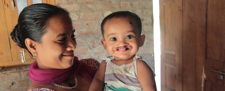 A surgical thread for the operation of a cleft child in India