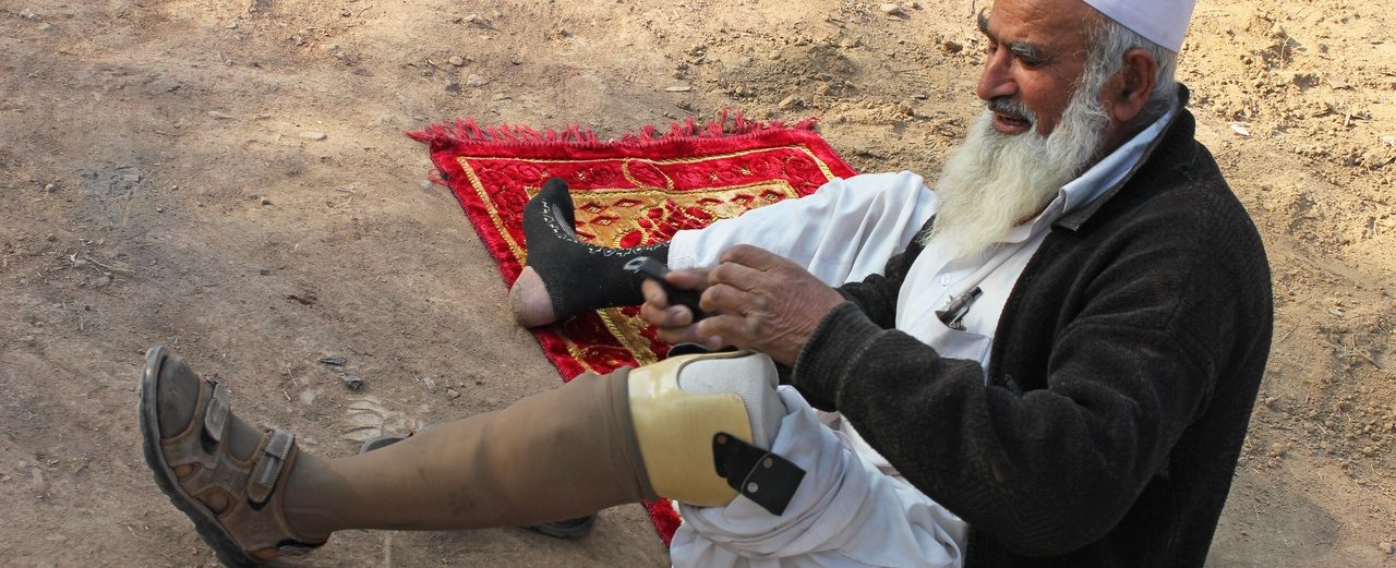 Fitting a prosthesis for an elderly person in Pakistan